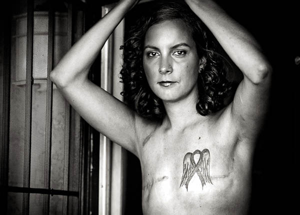 'Vết sẹo' - bộ ảnh gây choáng váng về ung thư vú