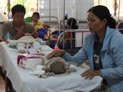 Thông tin sốc về vụ 5 người trong gia đình thương vong do bỏng xăng