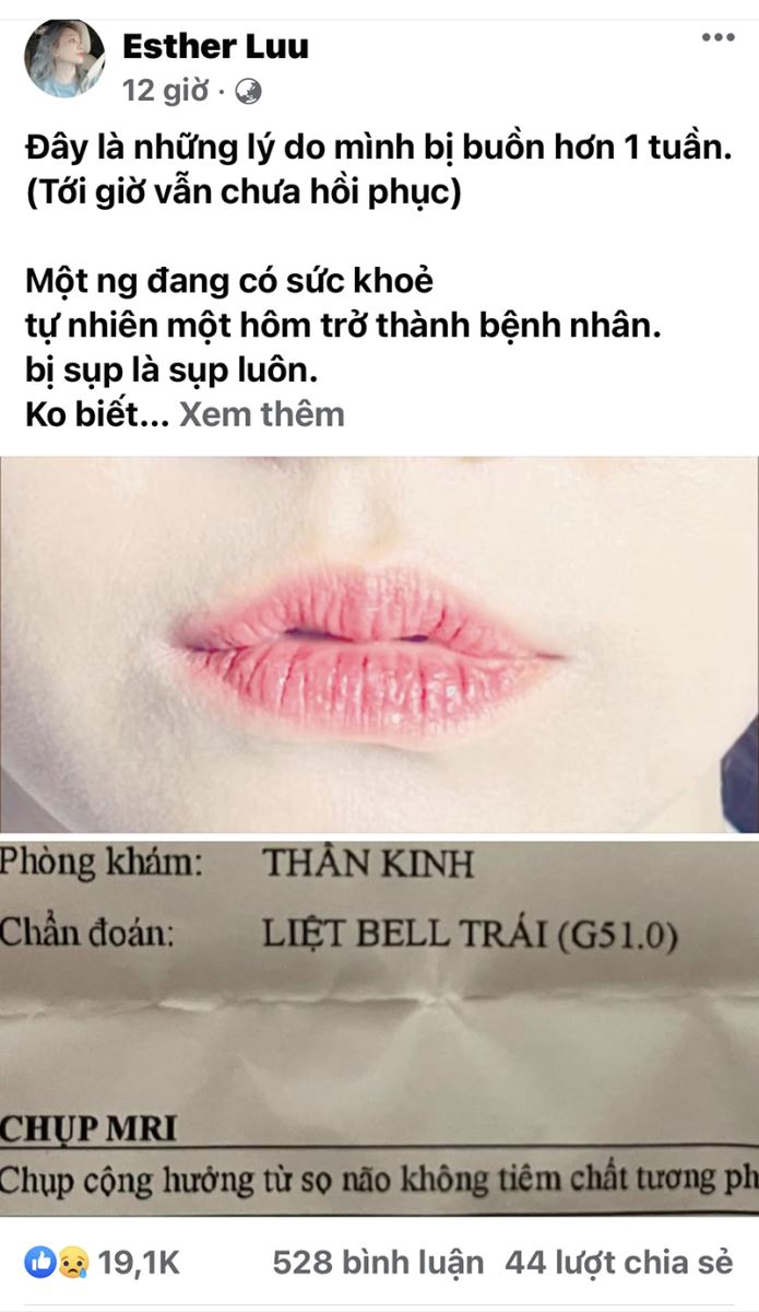 Hari Won bị liệt nửa mặt, Lý do Hari Won không thể cười, Bà xã Trấn Thành, Bà xã Trấn Thành bị liệt nửa mặt, Trấn Thành và Hari Won, Hari Won và Trấn Thành