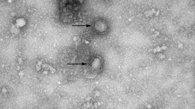 Dịch bệnh viêm phổi do virus corona: Mỹ xác nhận trường hợp thứ 5 nhiễm virus corona