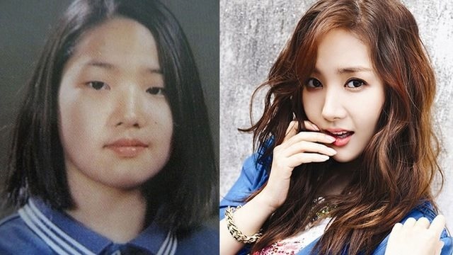 Sao Hàn phẫu thuật thẩm mỹ, diễn viên Hàn, Park Min Young, Lee Da Hae, Min Hyo Ri, kim nam joo, kim hyun joong, uee, thư ký Kim sao thế